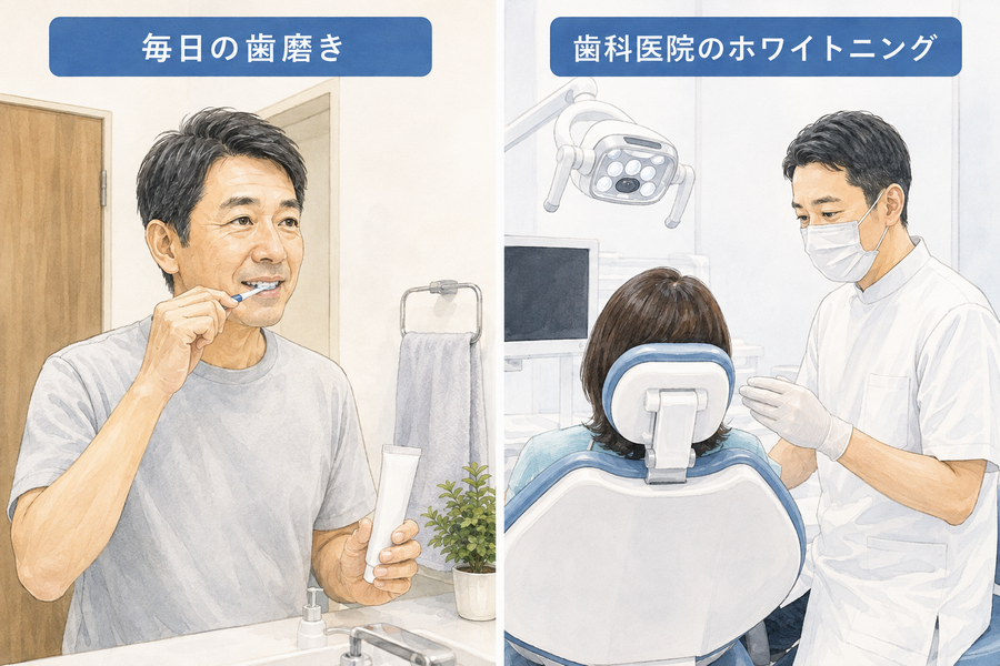 毎日の歯磨きと歯科医院のホワイトニングの違いを示すイラスト