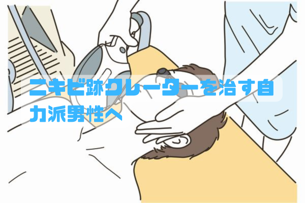 ニキビ跡のクレーターに悩みながらスキンケアを続ける男性のイメージ