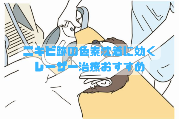 ニキビ跡の色素沈着に効果的なレーザー治療を受ける女性のイメージ