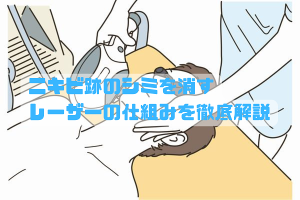 男性の顔の断面図にレーザー光がメラニンに反応して色素を分解する仕組みを示す図解