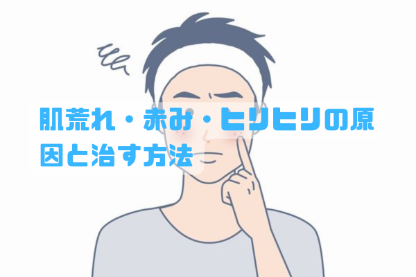 肌荒れの赤みやヒリヒリを落ち着かせる男性向けスキンケアのイメージ